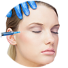 Botox