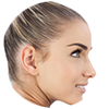 Fractional rf microneedling