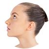 Skin tightening