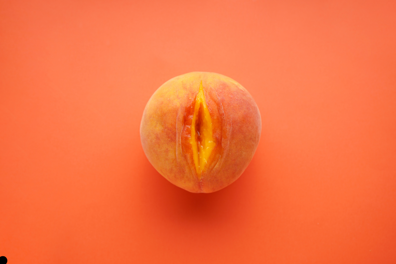 The Benefits of Labia Majora Augmentation with Fat Transfer in London: More than Aesthetic Enhancement